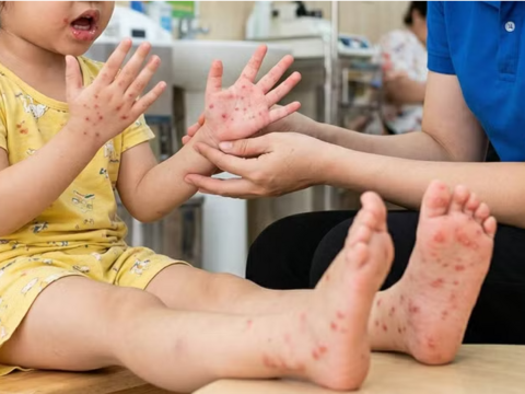 Phòng, chống bệnh tay chân miệng tại TPHCM: Dựng 'lá chắn' từ gia đình, nhà trường