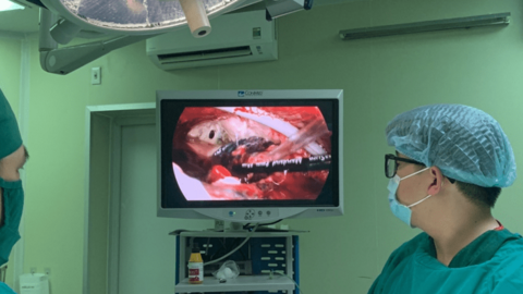 Phẫu thuật thành công cho bệnh nhân bị tràn mủ màng phổi